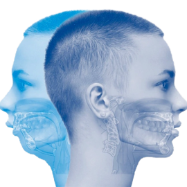 jaw-surgery-treatment